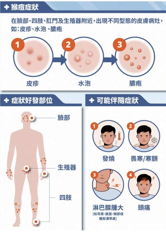 衞生防护中心称为猴痘新型病毒株「分支Ib」输入风险做好準备