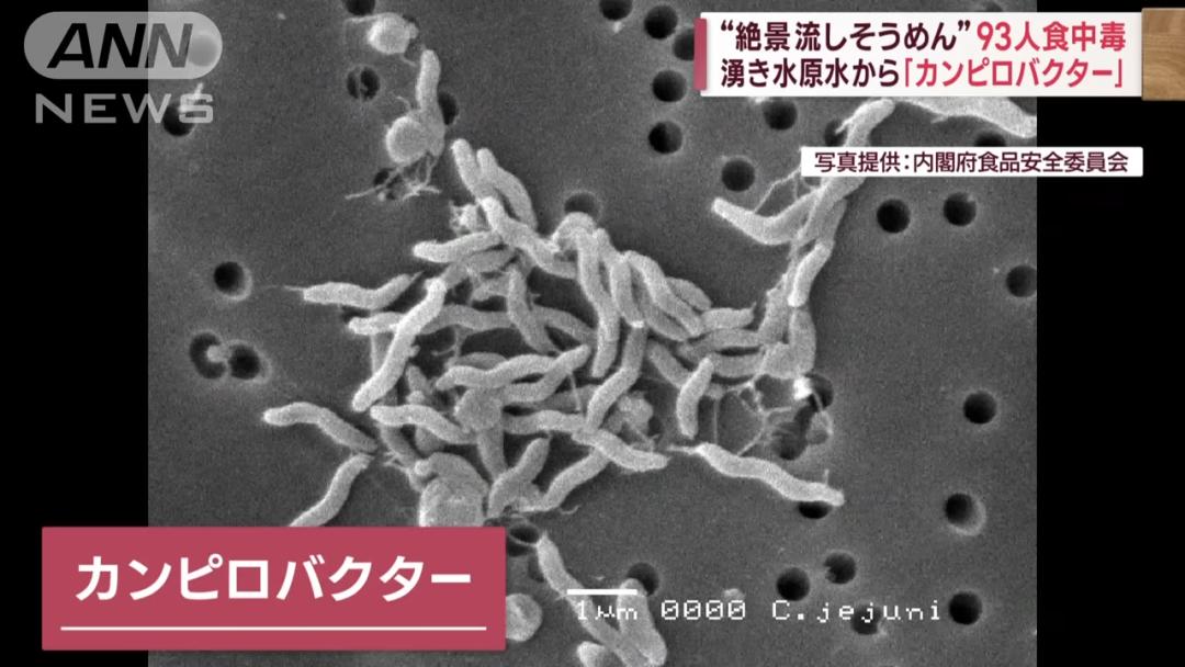 38岁女子内地注射肉毒桿菌毒素后怀疑中毒