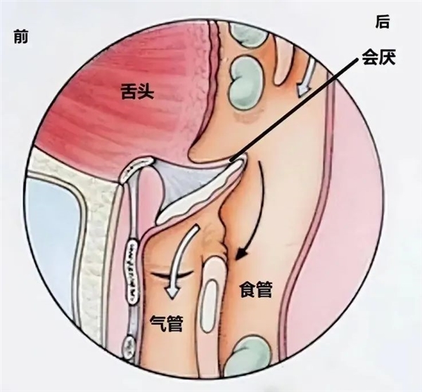 诡异的人类缺陷：吃饭时发出声音 竟会杀死自己